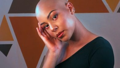 How to Support Your Wife if She is Diagnosed with Alopecia