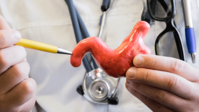 Understanding the Reversibility of Gastric Sleeve Surgery