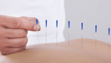 Does Acupuncture Worth It?