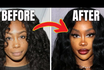 Sza Before Surgery