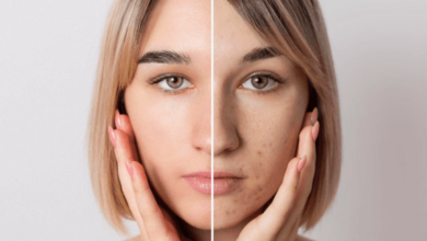 Transform Your Skin with Merz Aesthetics' Skin Tightening Solutions in Dubai