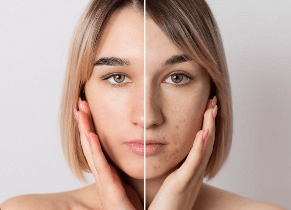 Transform Your Skin with Merz Aesthetics' Skin Tightening Solutions in Dubai