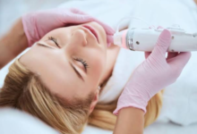 Microneedling with Radio Frequency: Transform Your Skin in Arlington, VA